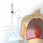 Pleura-und Thoraxdrainage-  Set Komplett-Set nach Matthys