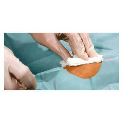 Lähikuva hansikoiduista käsistä, jotka puhdistavat pienen ihoalueen valkoisella liinalla, ympäröitynä sinivihreillä Hartmann Foliodrape® Protect rei'itetyillä liinoilla, itsekiinnittyvillä, steriileillä, yksittäin pakatuilla, Paul Hartmann AG:n.